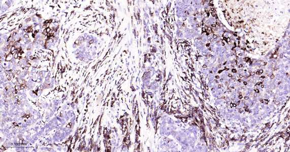 人环氧合酶2即用型免疫组化试剂盒-IHC0408H